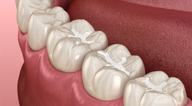 Close-up 3D illustration of white teeth and pink gum tissue showing dental anatomy and oral health.
